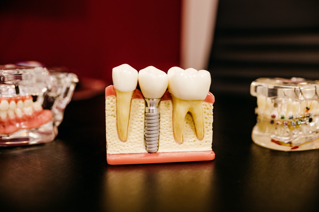 How Long Do Root Canals Take? The Ultimate Guide